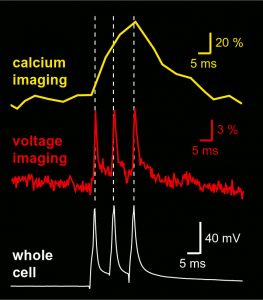 Sequential dendritic voltage imaging and dendritic calcium imaging from the same region of interest on a basal dendrite of layer 5 cortical pyramidal neuron
