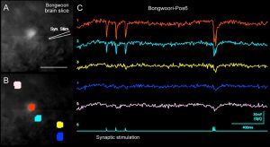 Voltage imaging in brain slices using Genetically Encoded Voltage Indicator (GEVI), Bongwoori-Pos6