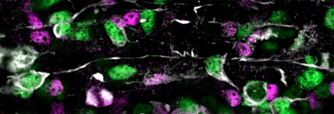 During development, the cerebral cortex contains diverse types of neural stem cells, which are differentially stained with Sox2 (green), Tbr2 (pink), and phospho-Vimentin (white)