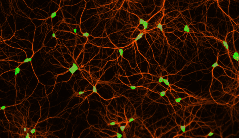 neurons