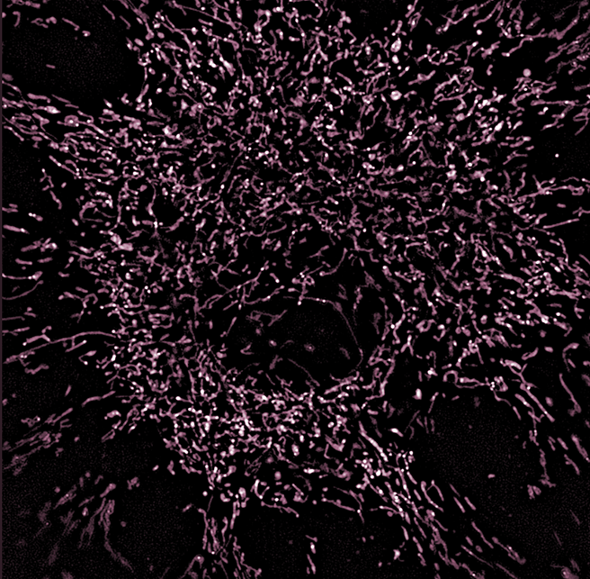 SIM Image of Mitochondria