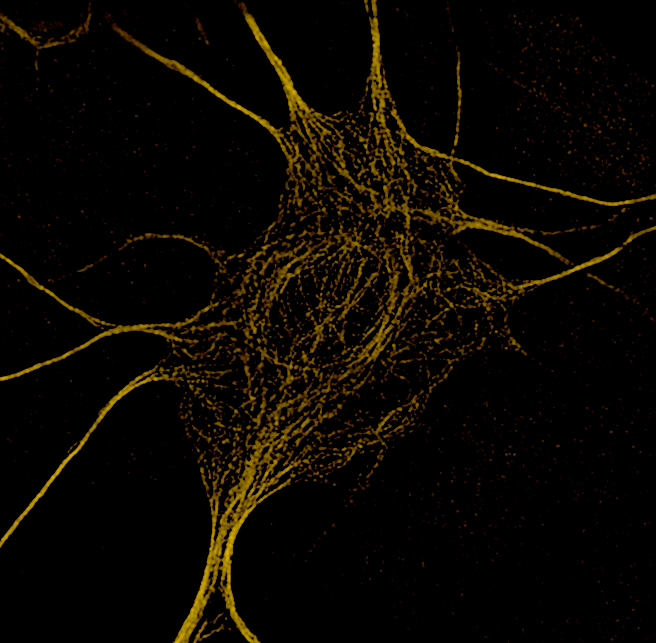 SIM of MAP2 Neuronal Culture 