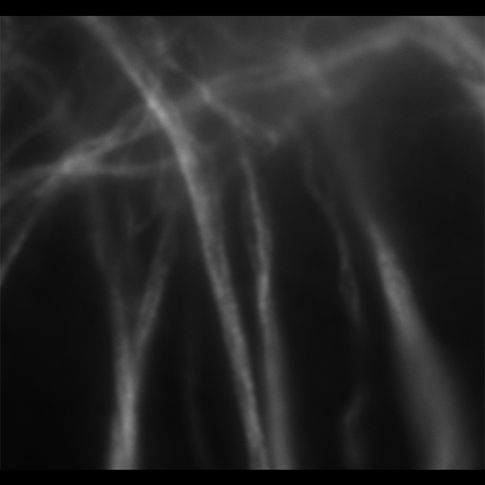 Zoomed Widefield Image of MAP2 Stained Neurons