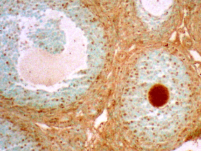 the expression of PGRMC1 within the immature rat ovary.