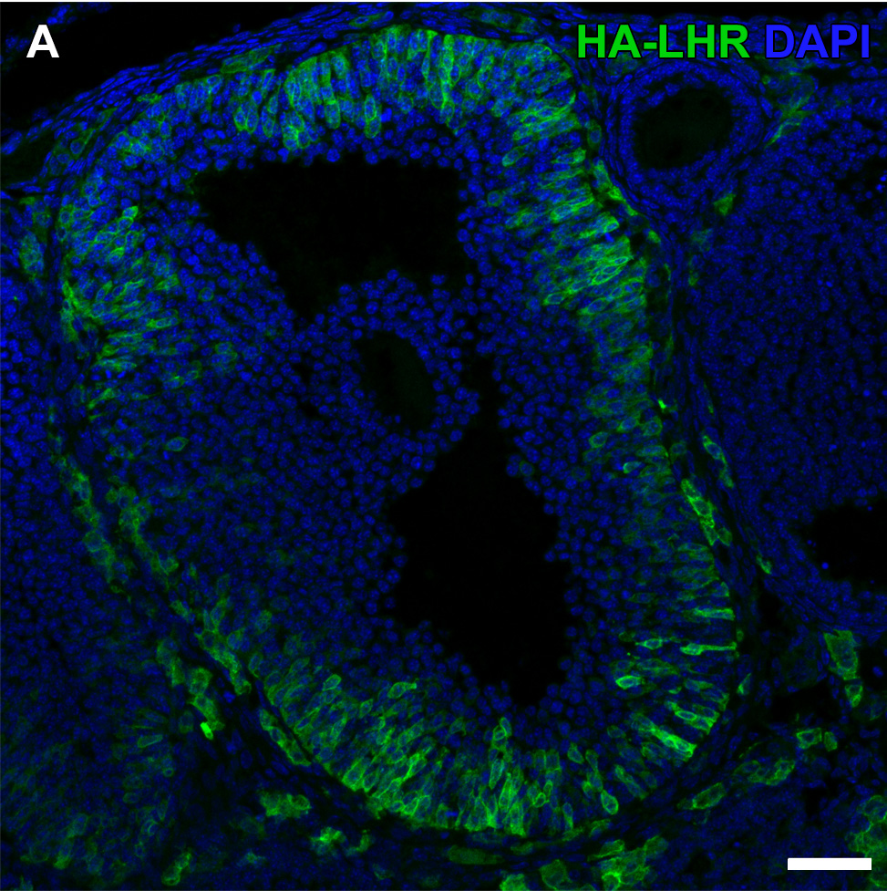 LH receptor heterogeneity in mouse ovarian follicle