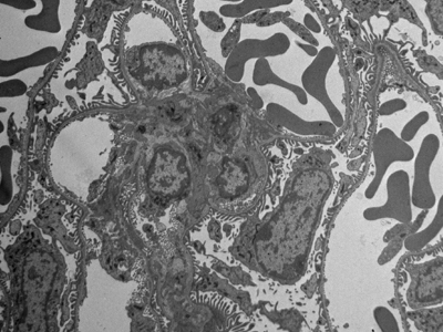 Thin section of mouse kidney glomeruli