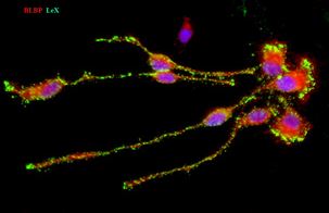 Fig. 2 Human radial glia cells 