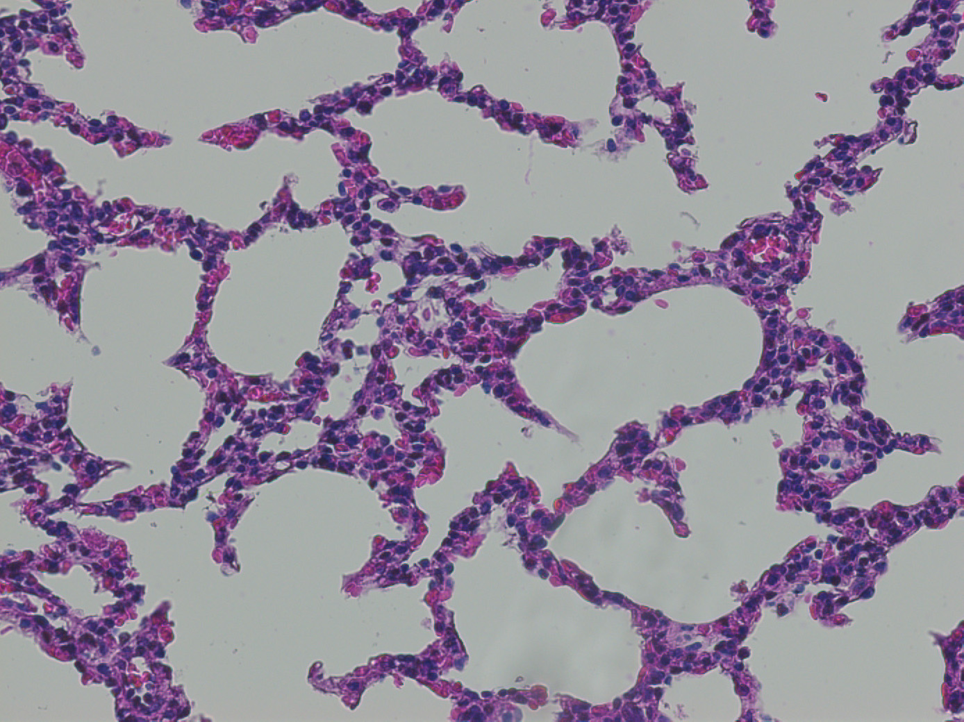 Lung Histology