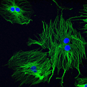 Confocal image of microtubule assembly in dividing mesenchymal stem cells labeled with anti-tubulin antibody (green). To-Pro stained nuclei are shown in blue.