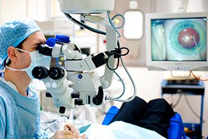 Cataract eye surgery in the operating room