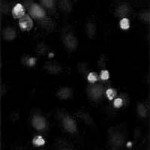 The morphology of rat ovarian surface epithelial cells (ROSE-179 cells) after 24 hours of culture under serum-free conditions.
