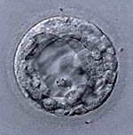 Figure: A human blastocyts derived from an oocytes that was fertilized in vitro by two sperm