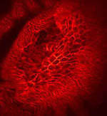 The epidermal cells of a Drosophila embryo