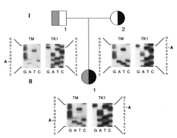 Figure: Family with compound heterozygosity for N540K and G380R mutations.