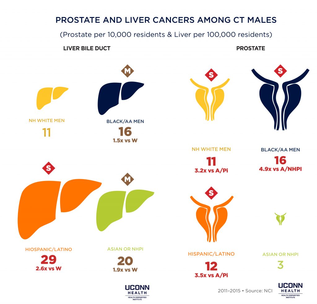 prostate liver cancer