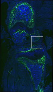 No GFP expression in cartilage or tendon region, HMWTg