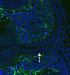 No GFP expression in cartilage or tendon region, HMWTg