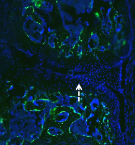 No GFP expression in cartilage or tendon region, vector