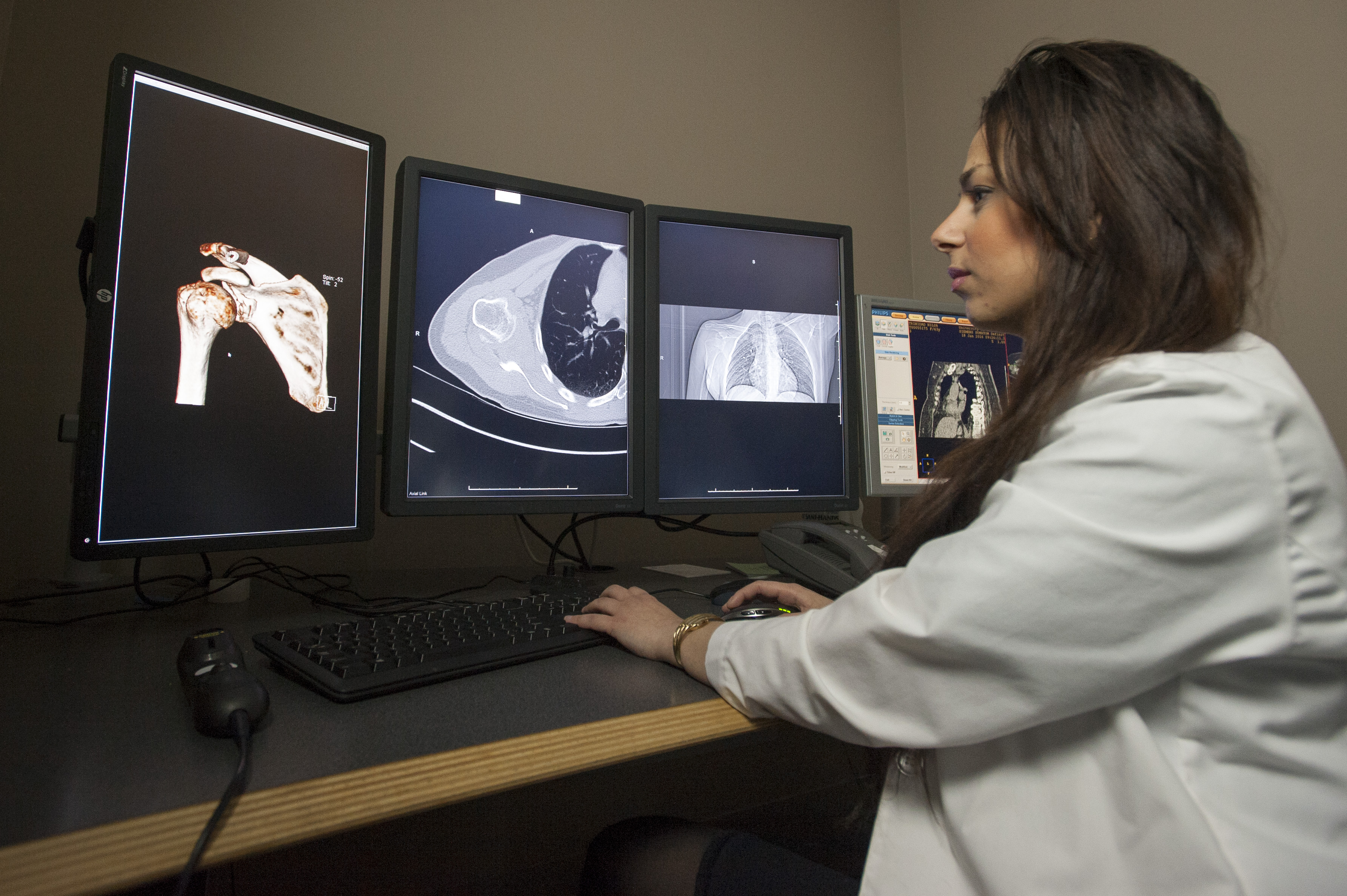 A radiology technician views X-rays at UConn Health