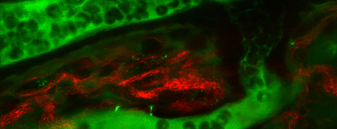 In vivo multiphoton imaging of plasma (green) with circulating blood cells in silhouette, collagen is in red by second harmonic imaging