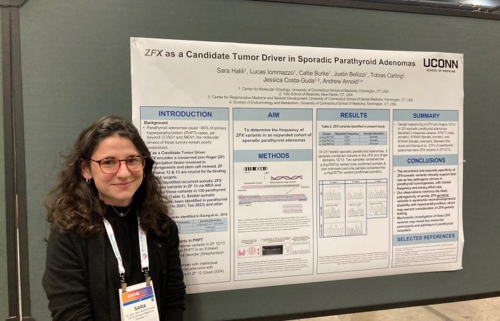 Sara Halili presenting her abstract poster "Pathogenic Variant Analysis of ZFX in Sporadic Parathyroid Adenomas" at the July 2025 Endocrine Society Annual Meeting in San Francisco, CA.