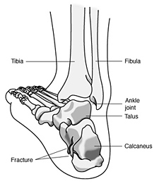 bones in the heel of your foot