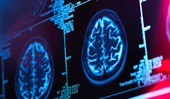 Scan of a brain