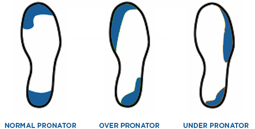 overpronation heel wear