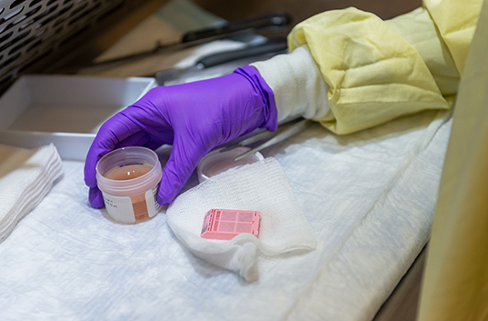 Gloved hand holding a specimen