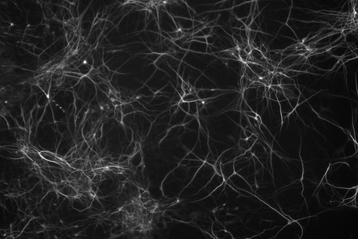 An immunofluorescent image of 14 week old neurons.