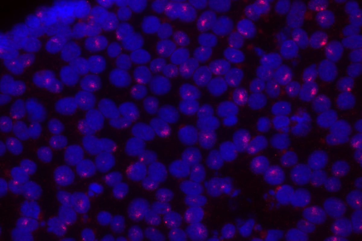 An image of cells with Xist clouds in iPSCs, identified by fluorescent in situ hybridization.
