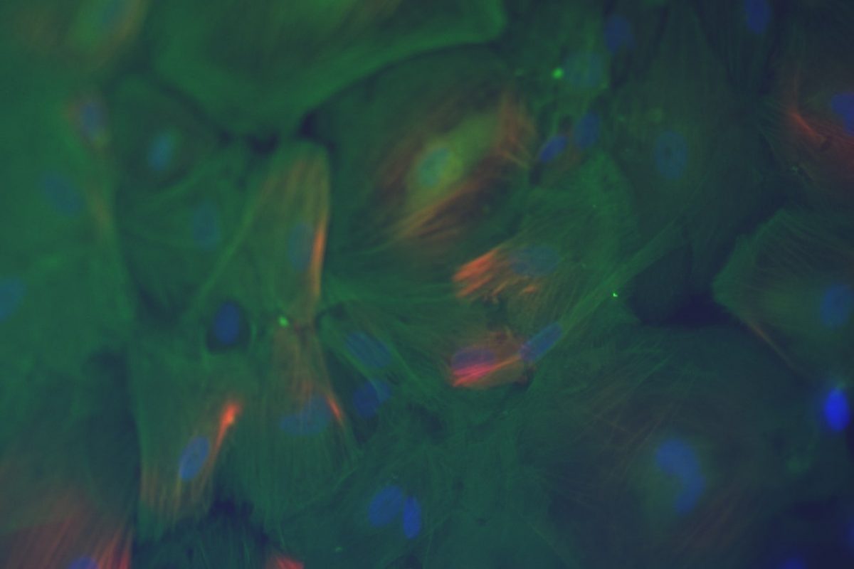 An immunofluorescence image of iPSC-derived smooth muscle cells.