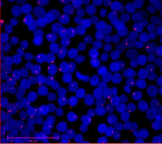 An image of cells with Xist clouds identified by fluorescent in situ hybridization.