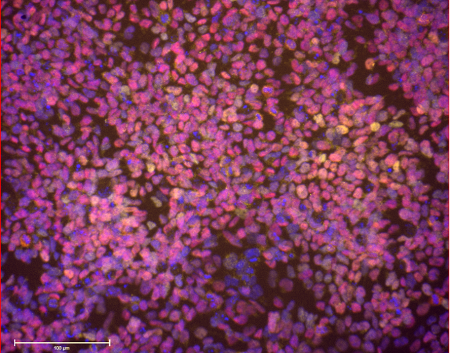 An immunofluorescence image of iPSC-derived neural crest cells.