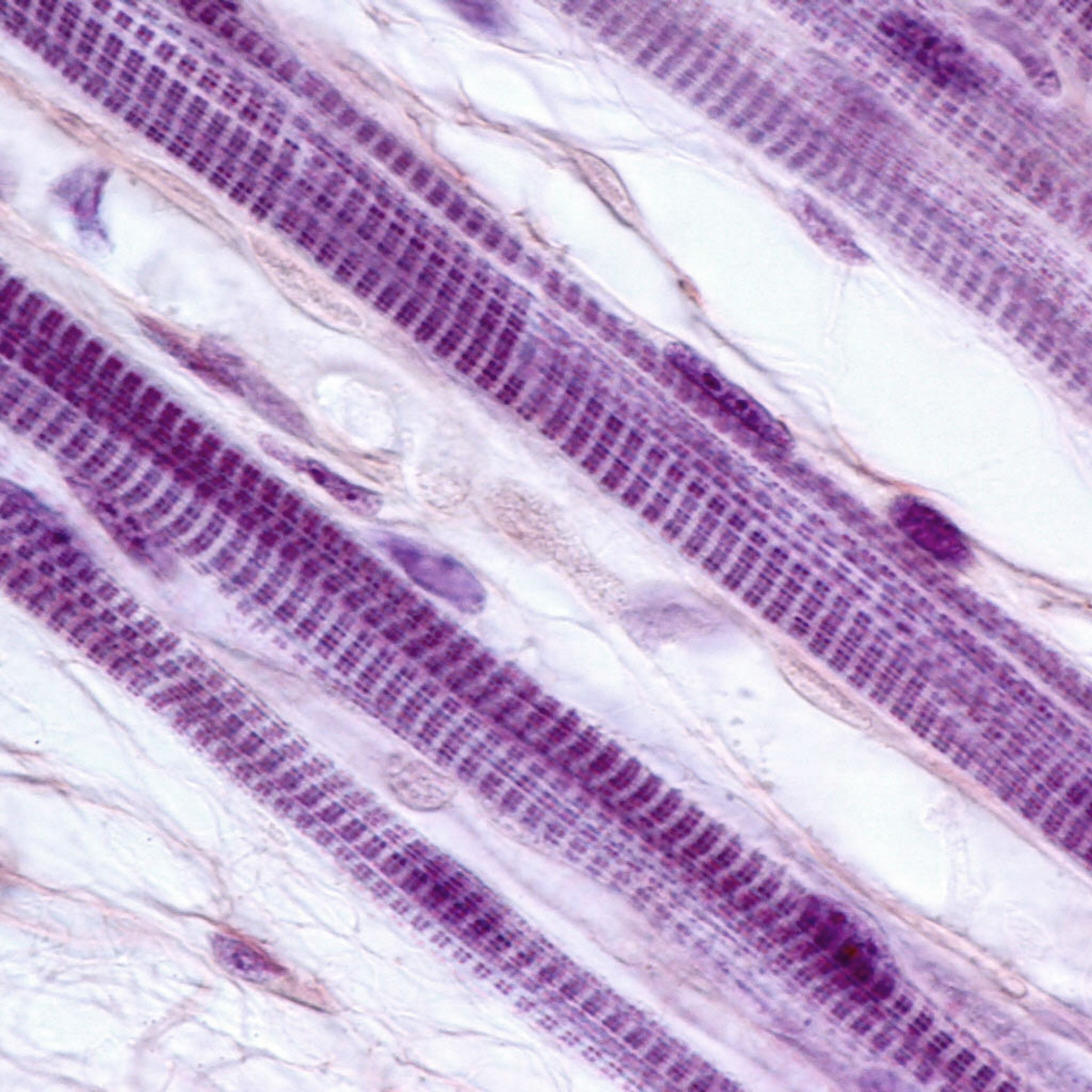 Skeletal muscle fibers (Shutterstock)