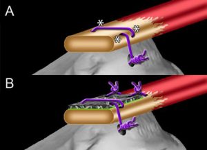 Regenerative Engineering Solutions to Rotator Cuff Tears