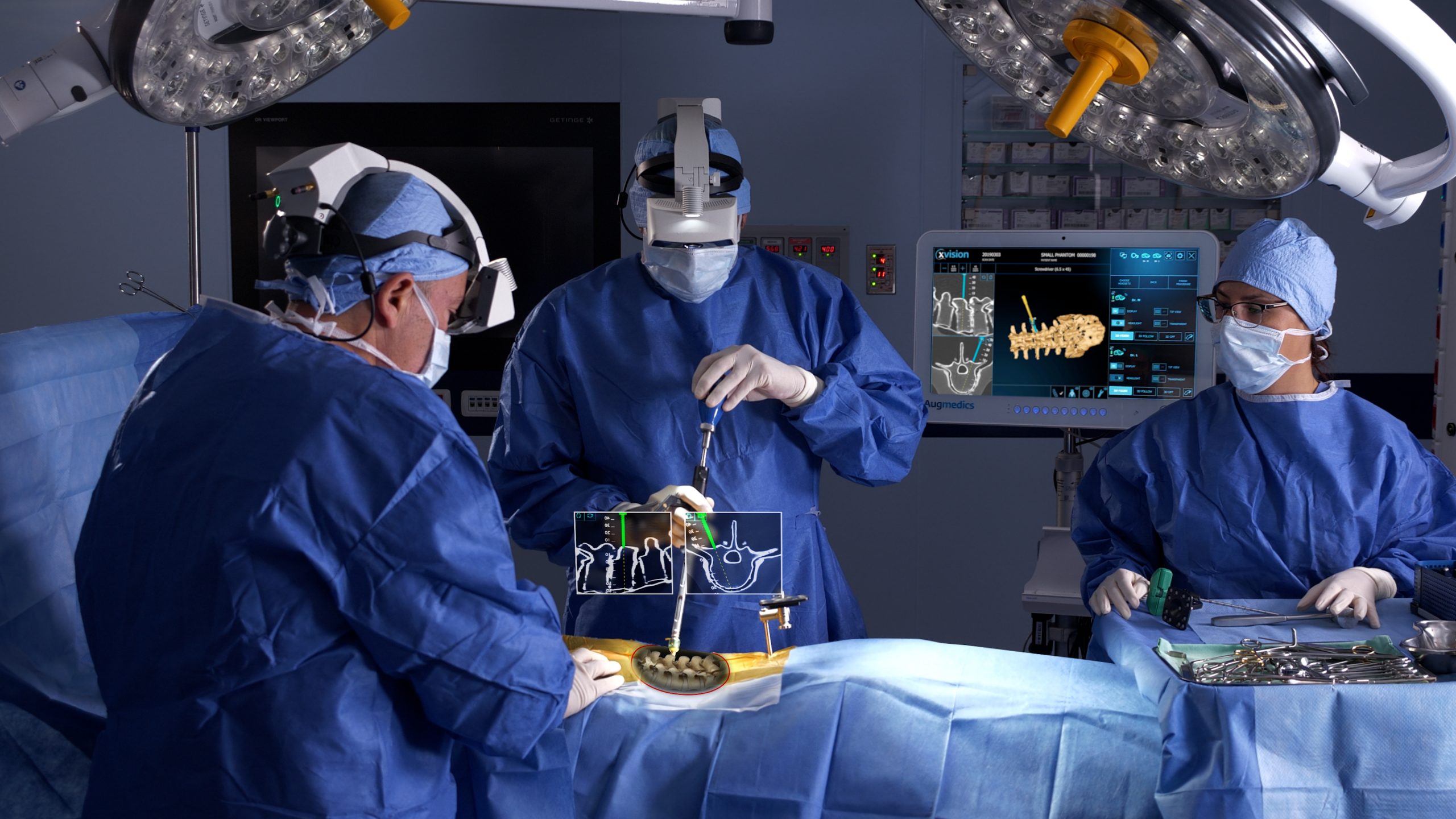Surgeons using the Augmedics xvision Spine System in the operating room