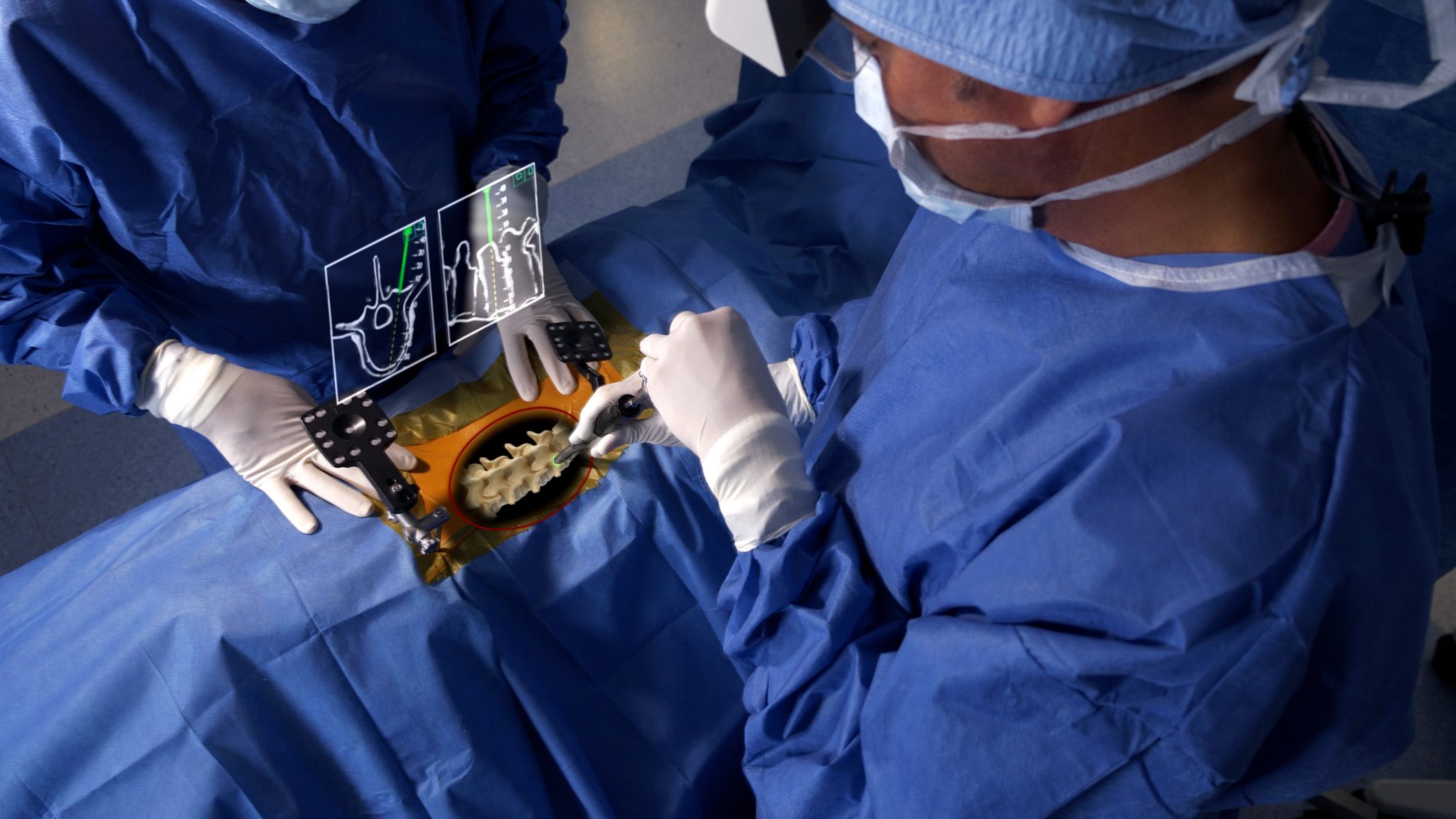 Minimally Invasive Spine Fusion Surgery Video