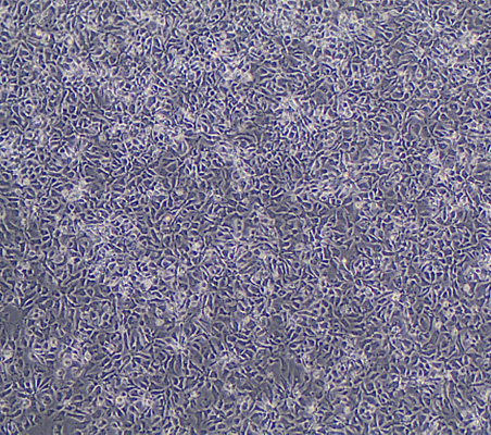 Brightfield image of human pluripotent stem cell-derived neural stem cells