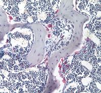 Light micrograph of trabecular bone with alkaline phosphatase-stained osteoclasts (pink) on the bone surface.
