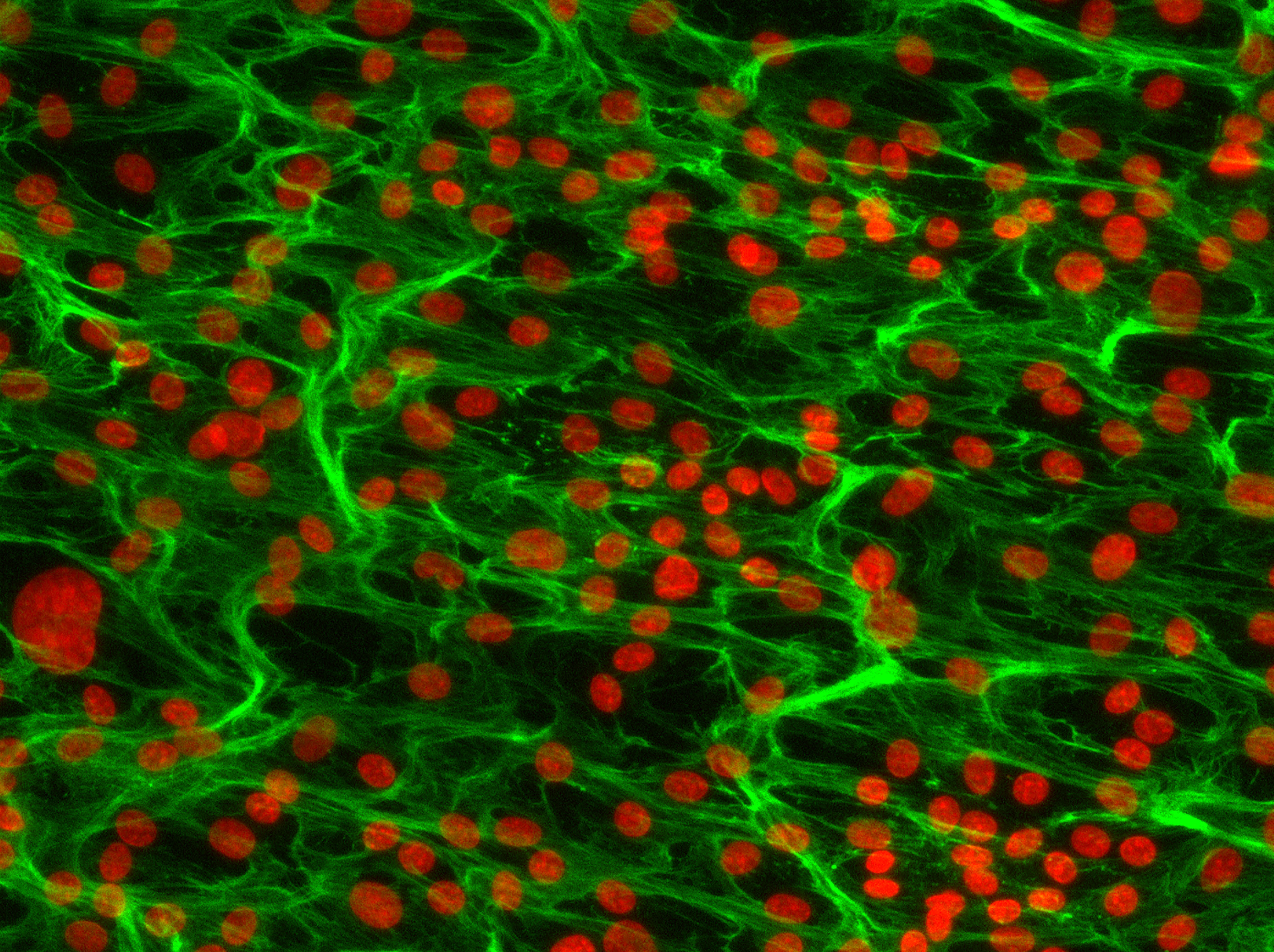 RNA splicing event regulated by disturbed flow across the endothelium