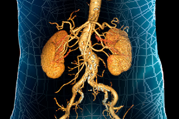 3D computed tomography (CT) angiogram showing the kidneys with renal arteries branching from the aorta