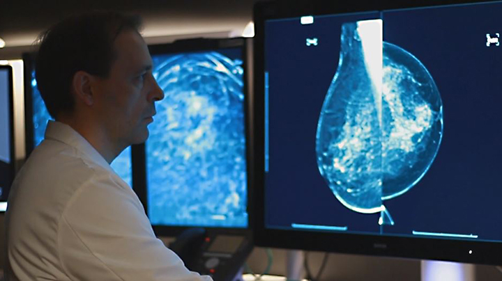power_of_possible_breast_cancer Alex Merkulov, M.D., reviewing a mammogram